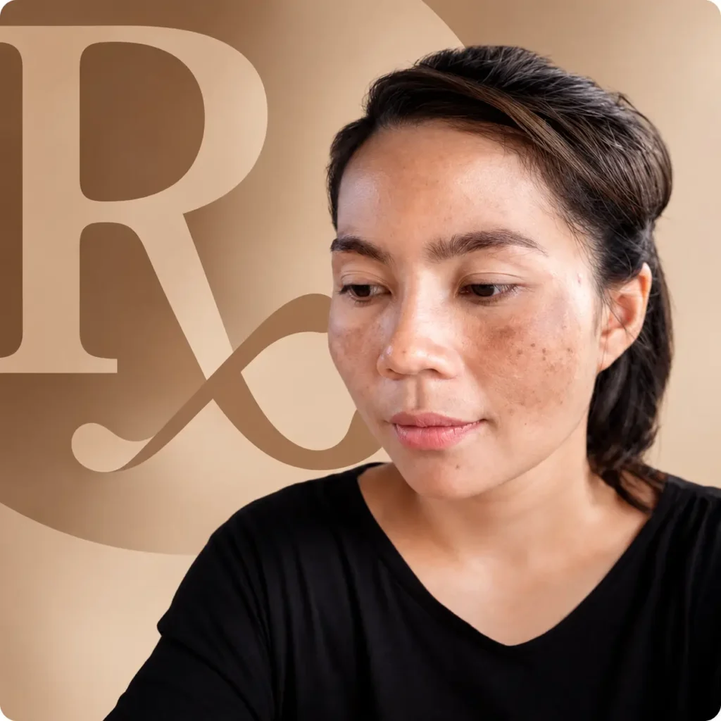 Woman with brown patches of melasma on her cheeks and nose, in a black T-shirt in front of a large Rx symbol, illustrating topical melasma medications